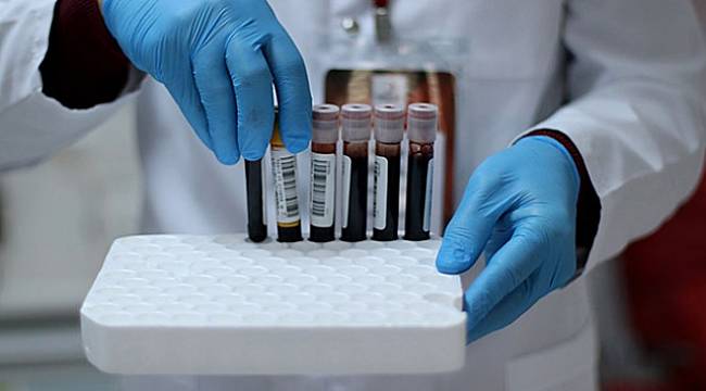 Diyanet&#039;ten Ramazan öncesi kan bağışı çağrısı