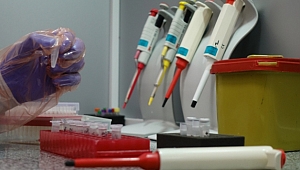 ELISA testi nedir, ELİSA ne demek, ELİSA test merkezleri ELİSA testi kimlere uygulanacak?